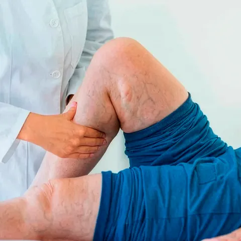 Angiologia